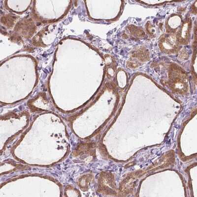 Immunohistochemistry-Paraffin: PRAGMIN Antibody [NBP1-87473] - Staining of human thyroid gland shows moderate cytoplasmic positivity in glandular cells.