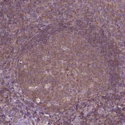 Immunohistochemistry-Paraffin: PRAGMIN Antibody [NBP1-87473] - Staining of human tonsil shows moderate cytoplasmic positivity in germinal center cells.