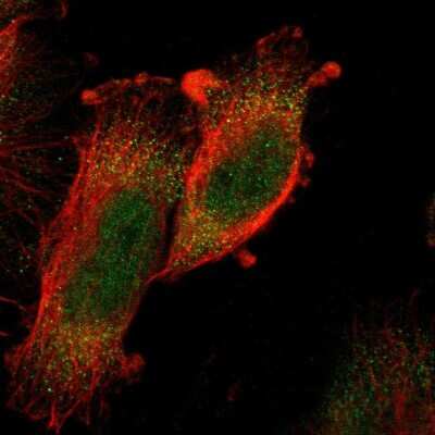 Immunocytochemistry/Immunofluorescence: PRAK Antibody [NBP1-87231] - Immunofluorescent staining of human cell line U-251 MG shows localization to nucleoplasm & cytosol.