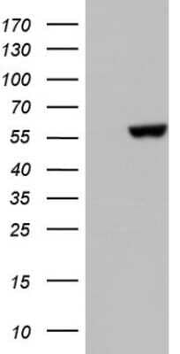 Western Blot: PRAK Antibody (OTI5E1) - Azide and BSA Free [NBP2-73594] - Analysis of HEK293T cells were transfected with the pCMV6-ENTRY control (Left lane) or pCMV6-ENTRY PRAK.
