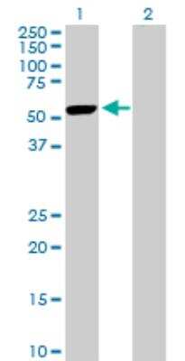 Western Blot: PRAK Antibody [H00008550-D01P] - analysis of MAPKAPK5 expression in transfected 293T cell line by MAPKAPK5 MaxPab rabbit polyclonal antibody. Lane 1: MAPKAPK5 transfected lysate (54.00 KDa). Lane 2: Non-transfected lysate.
