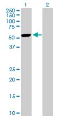 Western Blot: PRAK Antibody [H00008550-D01P] - Analysis of MAPKAPK5 expression in transfected 293T cell line by MAPKAPK5 polyclonal antibody.Lane 1: MAPKAPK5 transfected lysate(54.00 KDa).Lane 2: Non-transfected lysate.