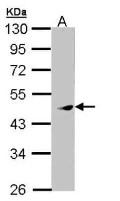 Western Blot: PRAK Antibody [NBP1-33093] - Sample (30 ug of whole cell lysate) A: Raji 10% SDS PAGE; antibody diluted at 1:1000.