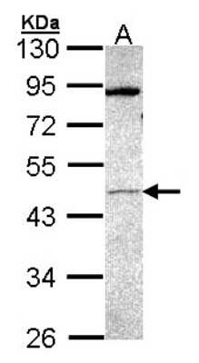 Western Blot: PRAK Antibody [NBP1-33769] - Sample (30 ug of whole cell lysate) A: Hep G2 10% SDS PAGE; antibody diluted at 1:1000.