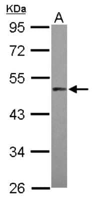 Western Blot: PRAK Antibody [NBP2-19922] - Sample (30 ug of whole cell lysate) A: HepG2 10% SDS PAGE gel, diluted at 1:1000.