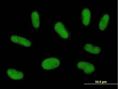 Immunocytochemistry/Immunofluorescence: PRAM1 Antibody [H00084106-B01P] - Analysis of purified antibody to PRAM1 on HepG2 cell. (antibody concentration 10 ug/ml)