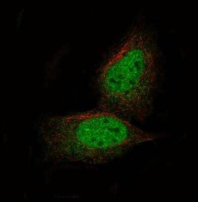 Immunocytochemistry/Immunofluorescence: PRAME Antibody (CL5146) [NBP2-61148] - Staining of U-2 OS cells using the Anti-PRAME monoclonal antibody, showing specific staining in the nucleus and cytosol in green. Microtubule- and nuclear probes are visualized in red and blue, respectively (where available). Antibody staining is shown in green.