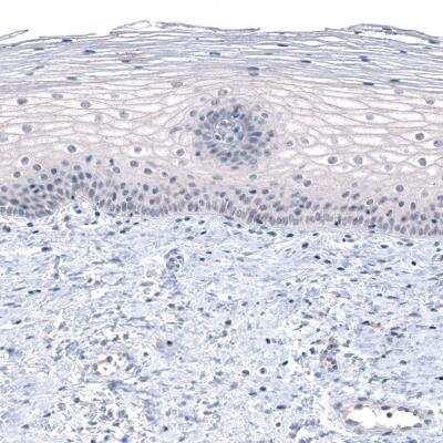 Immunohistochemistry-Paraffin: PRAME Antibody (CL5148) [NBP2-61149] - Staining of human cervix shows absence of positivity as expected (negative control).