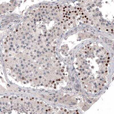 Immunohistochemistry-Paraffin: PRAME Antibody (CL5148) [NBP2-61149] - Staining of human testis shows moderate to strong nuclear immunoreactivity in a subset of cells in seminiferous tubules.