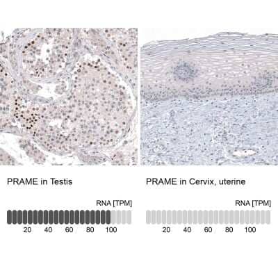 Immunohistochemistry-Paraffin: PRAME Antibody (CL5148) [NBP2-61149] - Analysis in human testis and cervix, uterine tissues using NBP2-61149 antibody. Corresponding PRAME RNA-seq data are presented for the same tissues.