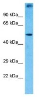 Western Blot: PRAMEF1 Antibody [NBP3-09880] - Western blot analysis of PRAMEF1 in Jurkat Whole Cell lysates. Antibody dilution at 1.0ug/ml