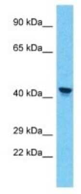 Western Blot: PRAMEF11 Antibody [NBP3-09923] - Western blot analysis of PRAMEF11 in Human A549 Whole Cell. Antibody dilution at 1ug/ml
