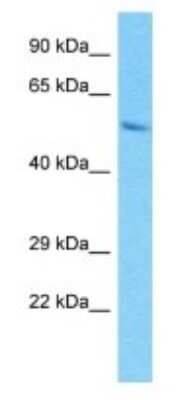 Western Blot: PRAMEF15 Antibody [NBP3-09881] - Western blot analysis of PRAMEF15 in HepG2 Whole Cell lysates. Antibody dilution at 1.0ug/ml