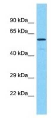 Western Blot: PRAMEF17 Antibody [NBP3-09882] - Western blot analysis of PRAMEF17 in 721_B Whole Cell lysates. Antibody dilution at 1.0ug/ml