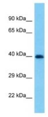Western Blot PRAMEF19 Antibody - BSA Free