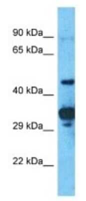 Western Blot: PRAMEF2 Antibody [NBP3-09922] - Western blot analysis of PRAMEF2 in Human OVCAR-3 Whole Cell. Antibody dilution at 1ug/ml