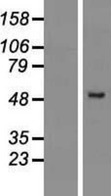 Western Blot: PRAMEF2 Overexpression Lysate (Adult Normal) [NBL1-14727] Left-Empty vector transfected control cell lysate (HEK293 cell lysate); Right -Over-expression Lysate for PRAMEF2.