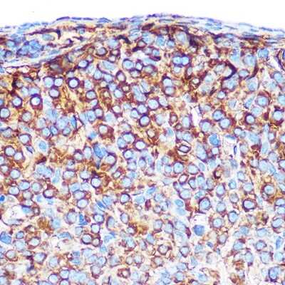 Immunohistochemistry-Paraffin: PRAMEF20 Antibody [NBP3-05595] - Immunohistochemistry of paraffin-embedded mouse ovary using PRAMEF20 Rabbit pAb (NBP3-05595) at dilution of 1:100 (40x lens).