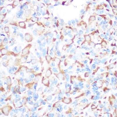 Immunohistochemistry-Paraffin: PRAMEF20 Antibody [NBP3-05595] - Immunohistochemistry of paraffin-embedded rat ovary using PRAMEF20 Rabbit pAb (NBP3-05595) at dilution of 1:100 (40x lens).