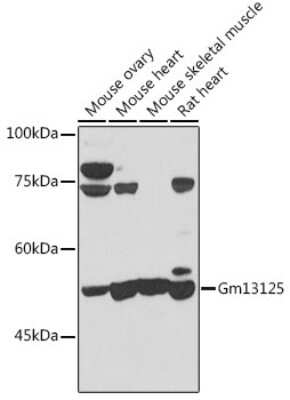 Western Blot: PRAMEF20 Antibody [NBP3-05595] - Western blot analysis of extracts of various cell lines, using PRAMEF20 antibody (NBP3-05595) at 1:1000 dilution. Secondary antibody: HRP Goat Anti-Rabbit IgG (H+L) at 1:10000 dilution. Lysates/proteins: 25ug per lane. Blocking buffer: 3% nonfat dry milk in TBST. Detection: ECL Basic Kit. Exposure time: 30s.