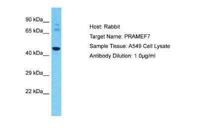 Western Blot: PRAMEF7 Antibody [NBP2-85524] - Host: Rabbit. Target Name: PRAMEF7. Sample Type: A549 Whole Cell lysates. Antibody Dilution: 1.0ug/ml
