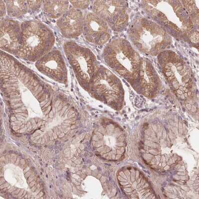 Immunohistochemistry-Paraffin: PRAS40 Antibody [NBP2-57165] - Immunohistochemical staining of human stomach shows cytoplasmic and nuclear positivity in glandular cells.
