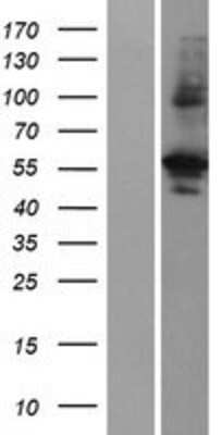 Western Blot PRAS40 Overexpression Lysate