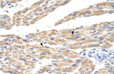 Immunohistochemistry: PRAT4A/TNRC5 Antibody [NBP2-88087] - Human Muscle