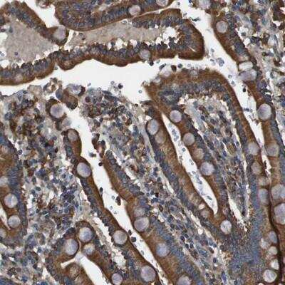 Immunohistochemistry-Paraffin: PRAT4A/TNRC5 Antibody [NBP1-91153] - Staining of human duodenum shows strong cytoplasmic positivity in glandular cells.