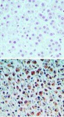 Immunohistochemistry-Paraffin: PRAT4A/TNRC5 Antibody [NBP2-23847] - Aalysis of PRAT4A in formalin-fixed paraffin-embedded human liver tissue using an isotype control antibody (top) and PRATA4 antibody(bottom) at 1:2000.