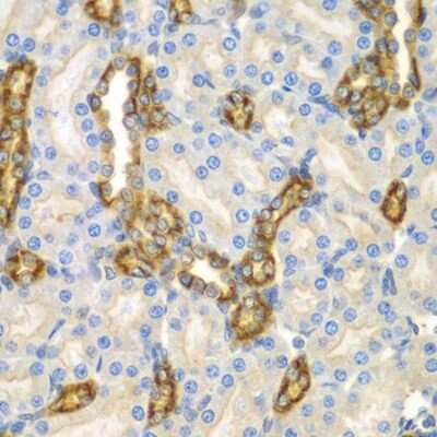 Immunohistochemistry-Paraffin: PRAT4A/TNRC5 Antibody [NBP2-93610] - Paraffin-embedded mouse kidney using PRAT4A/TNRC5 .