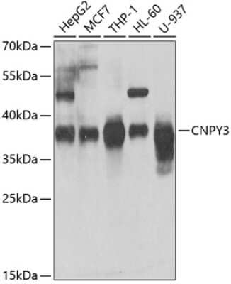 Western Blot: PRAT4A/TNRC5 Antibody [NBP2-93610] - Analysis of extracts of various cell lines, using PRAT4A/TNRC5 .Exposure time: 15s.