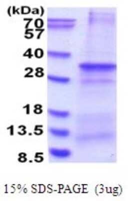 SDS-Page: PRAT4B/CNPY4 Recombinant Protein [NBP2-51710] - 15% SDS Page (3 ug)