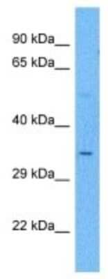 Western Blot PRB3 Antibody