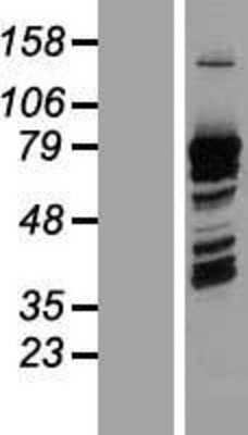 Western Blot: PRC1 Overexpression Lysate (Adult Normal) [NBL1-14729] Left-Empty vector transfected control cell lysate (HEK293 cell lysate); Right -Over-expression Lysate for PRC1.