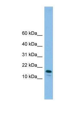 Western Blot: PRDC/GREM2 Antibody [NBP1-57598] - 721_B cell lysate, concentration 0.2-1 ug/ml.