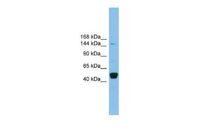 Western Blot: PRDM10 Antibody [NBP2-85526] - WB Suggested Anti-PRDM10 Antibody Titration: 0.2-1 ug/ml. ELISA Titer: 1:312500. Positive Control: THP-1 cell lysate