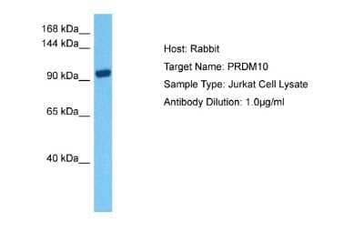 Western Blot: PRDM10 Antibody [NBP2-85527] - Host: Rabbit. Target Name: PRDM10. Sample Tissue: Human Jurkat Whole Cell lysates. Antibody Dilution: 1ug/ml