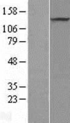 Western Blot: PRDM10 Overexpression Lysate (Adult Normal) [NBL1-14734] Left-Empty vector transfected control cell lysate (HEK293 cell lysate); Right -Over-expression Lysate for PRDM10.