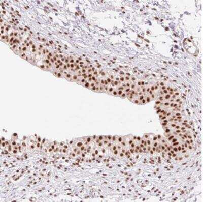 Immunohistochemistry: PRDM11 Antibody [NBP2-30650] - Staining of human urinary bladder shows strong nuclear positivity in urothelial cells.