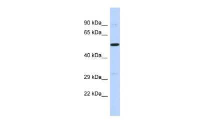 Western Blot: PRDM11 Antibody [NBP2-85528] - Host: Rabbit. Target Name: PRDM11. Sample Type: 721_B Whole cell lysates. Antibody Dilution: 1.0ug/mlPRDM11 is supported by BioGPS gene expression data to be expressed in 721_B