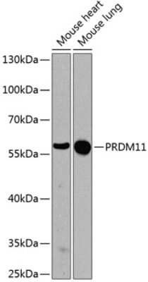 Western Blot: PRDM11 Antibody [NBP2-94711] - Analysis of extracts of various cell lines, using PRDM11 antibody  at 1:1000 dilution.Secondary antibody: HRP Goat Anti-Rabbit IgG (H+L) at 1:10000 dilution.Lysates/proteins: 25ug per lane. Blocking buffer: 3% nonfat dry milk in TBST.Detection: ECL Enhanced Kit. Exposure time: 90s.