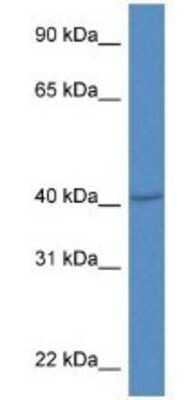 Western Blot: PRDM12 Antibody [NBP1-79697] - Mouse Thymus Lysate 1ug/ml  Gel Concentration 12%