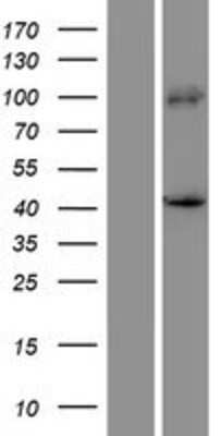 Western Blot: PRDM12 Overexpression Lysate (Adult Normal) [NBP2-06529] Left-Empty vector transfected control cell lysate (HEK293 cell lysate); Right -Over-expression Lysate for PRDM12.