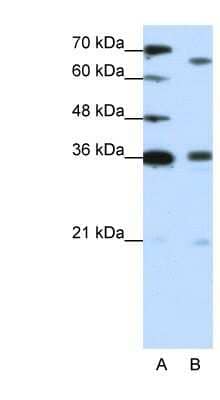 Western Blot: PRDM13 Antibody [NBP1-80361] - Jurkat cell lysate, concentration 1.25ug/ml.