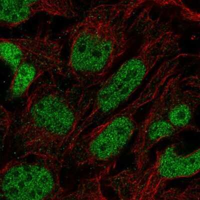 Immunocytochemistry/Immunofluorescence: PRDM16/MEL1 Antibody [NBP2-58350] - Staining of human cell line CACO-2 shows localization to nucleoplasm.