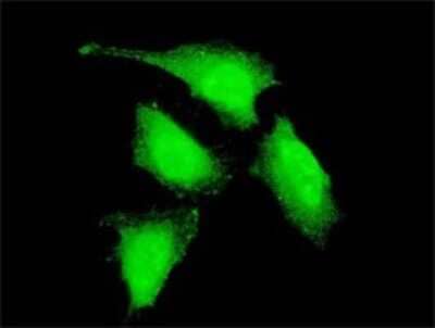 Immunocytochemistry/Immunofluorescence: PRDM4 Antibody (2C11) [H00011108-M02] - Analysis of monoclonal antibody to PRDM4 on HeLa cell . Antibody concentration 10 ug/ml.