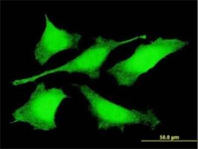 Immunocytochemistry/Immunofluorescence: PRDM4 Antibody (3C4) [H00011108-M01] - Analysis of monoclonal antibody to PRDM4 on HeLa cell . Antibody concentration 10 ug/ml.