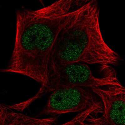 Immunocytochemistry/Immunofluorescence: PRDM4 Antibody [NBP2-55794] - Staining of human cell line SK-MEL-30 shows localization to nucleoplasm.