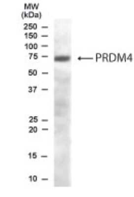 Western Blot: PRDM4 Antibody [NB100-1469] - NB100-1469 (0.3ug/ml) staining of Human Brain lysate (35ug protein in RIPA buffer). Primary incubation was 1 hour. Detected by chemiluminescence.
